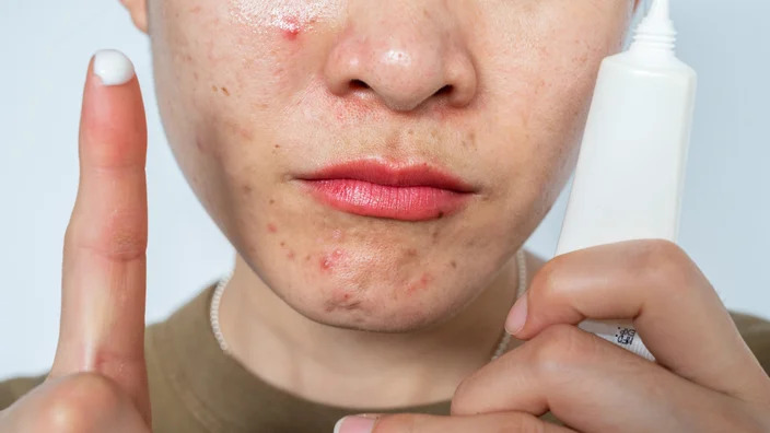 how-does-retinol-work-8_11zon