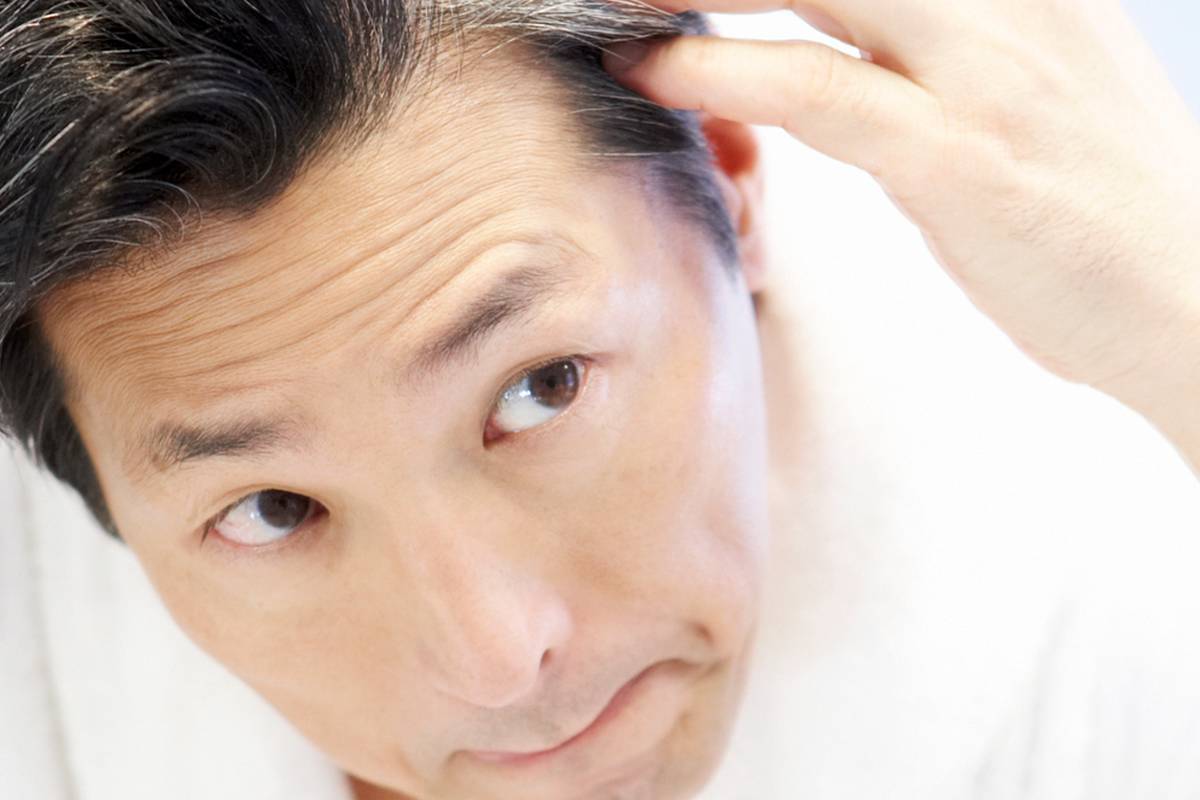 بهترین راه برای درمان شوره سر در خانه