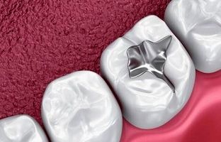 یک راه‌حل علمی برای محافظت از دندان مقابل نوشابه