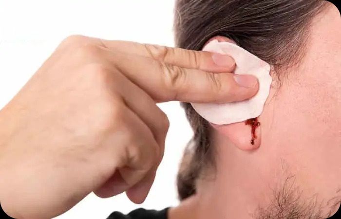 اتفاق ساده ای که پرده گوش را پاره می کند 