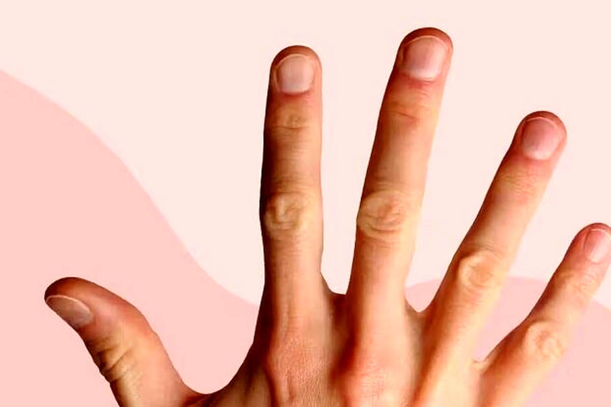 پیشگویی بیماریها با ناخن!