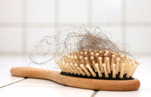 مهمترین دلایل ریزش موهای سر | ریزش چند تار مو در روز طبیعی است؟