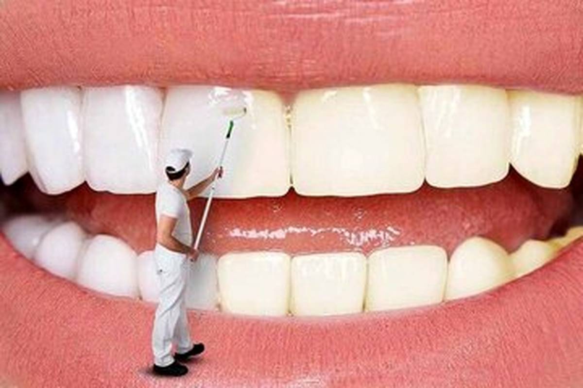 چطور از زردشدن دندانها جلوگیری کنیم؟/ ۷ روش برای سفیدکردن طبیعی دندانها در خانه