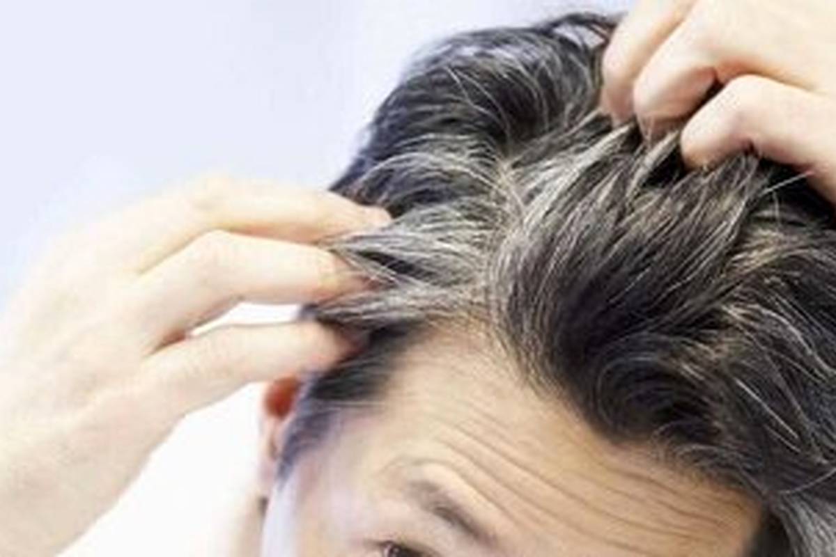 جلوگیری از سفید شدن مو با مصرف این ماده غذایی