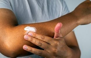 آیا افراد با پوست تیره هم به ضد آفتاب نیاز دارند؟
