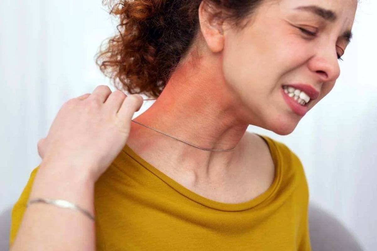 علائم حساسیت به بدلیجات و راه حلهایی برای رفع آن