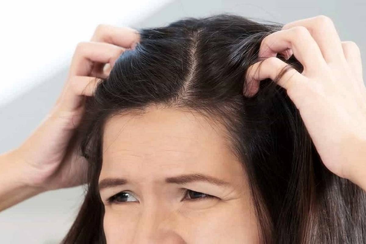 چرا دچار خارش کف سر میشویم؟ چه درمانی دارد؟