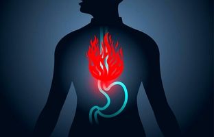 رفلاکس معده چیست؟ علت، علائم و راه‌های درمان اسید معده