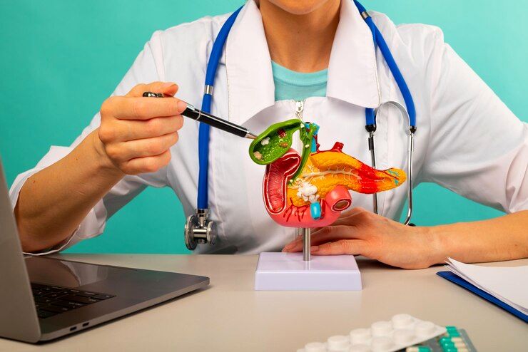 سرطان «پانکراس» یا سرطان «لوزالمعده» چیست و چه علائمی دارد؟ پیشگیری و راه‌های درمان