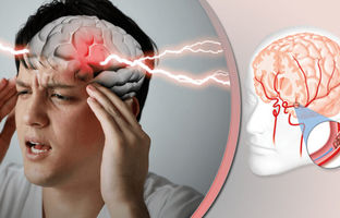 کدام استان‌ها بیشترین آمار سکته مغزی را دارد؟