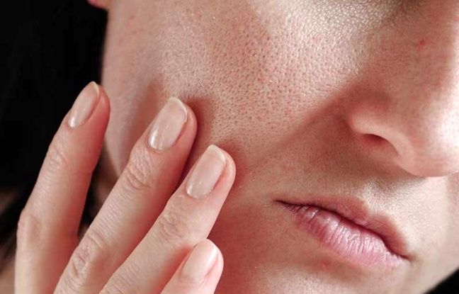از ریزش مو تا چین و چروک پوست؛ اولین اصل جوان ماندن چیست؟ + ویدئو