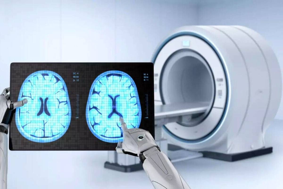 
تشخیص ۹ نوع زوال عقل با یک اسکن توسط هوش مصنوعی
