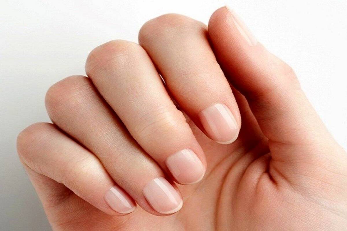تغییر رنگ ناخن به قهوه ای یا زرد نشانه چیست؟