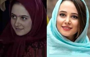تغییرات باورنکردنی بازیگران زن ایرانی پس از عمل زیبایی + ویدئو