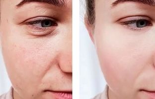 برای خشکی بدن چی بخوریم؟