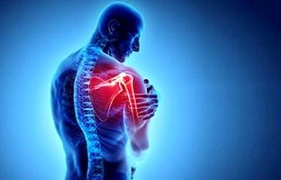 سندروم گیرافتادگی شانه چیست؟