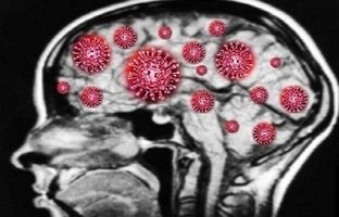 یک دلیل ابتلا به کرونای طولانی مدت مشخص شد