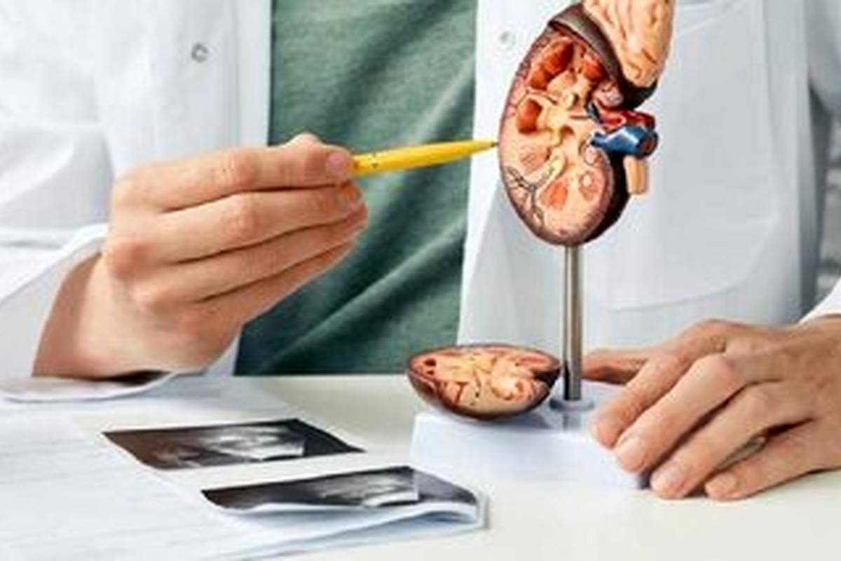 ارتباط بین سنگ کلیه و دیابت/ قند خون بالا باعث سنگ کلیه میشود؟