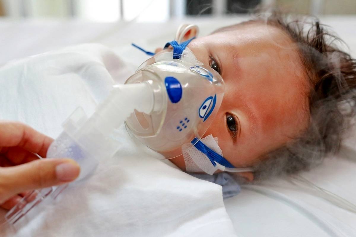 ویروس RSV چیست و چه علائمی دارد؟