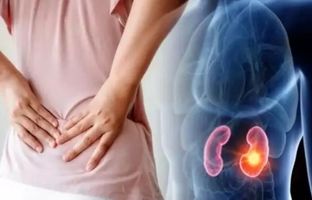 این بیماری هیچ علائمی ندارد؛ تشخیص آن فقط با سونوگرافی + ویدئو