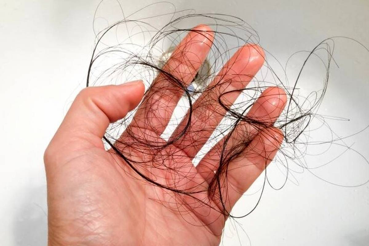 خوراکیهای مفید برای جلوگیری از ریزش مو