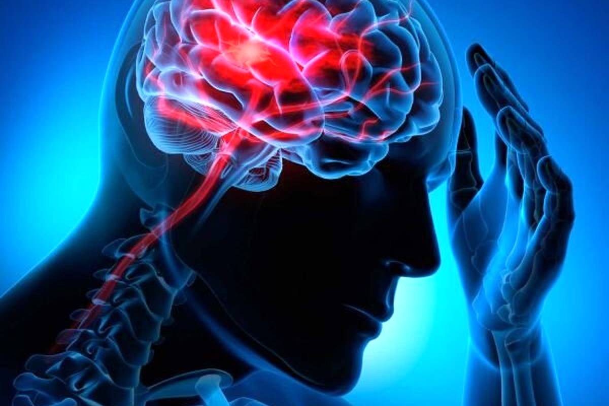 عوامل افزایش سکتههای مغزی در جهان
